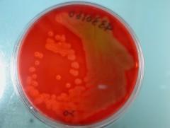 Scarlet Fever Bacteria